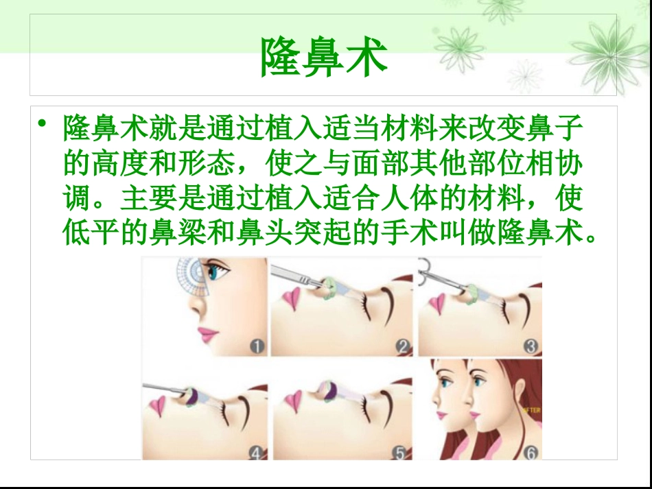 鼻部整形隆鼻术ppt课件_第6页