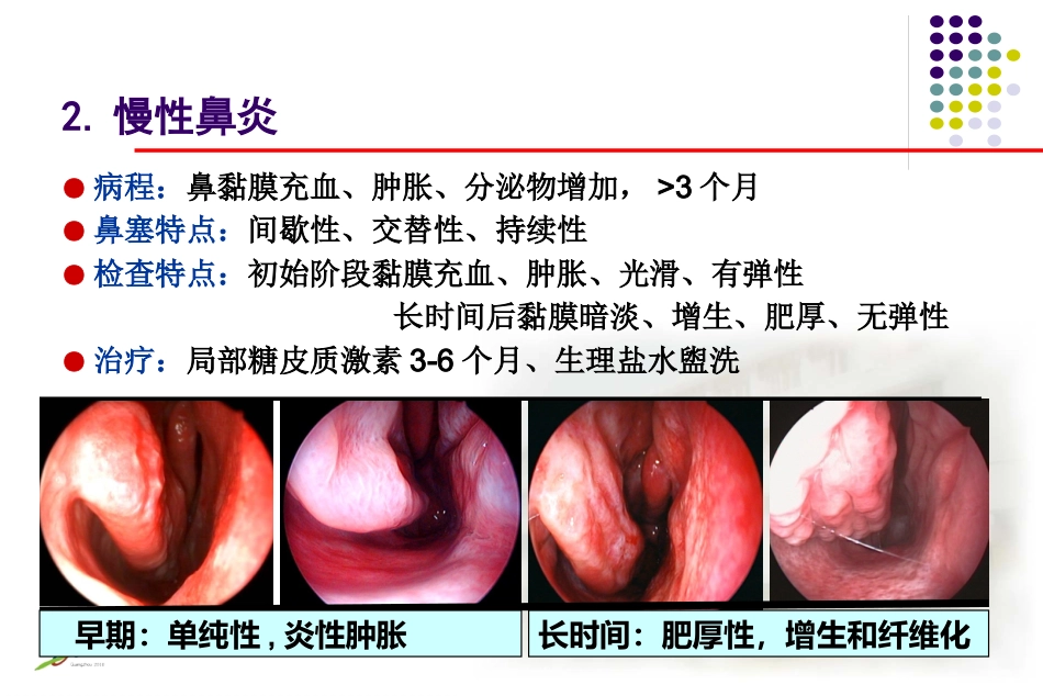 鼻炎课程课件_第12页