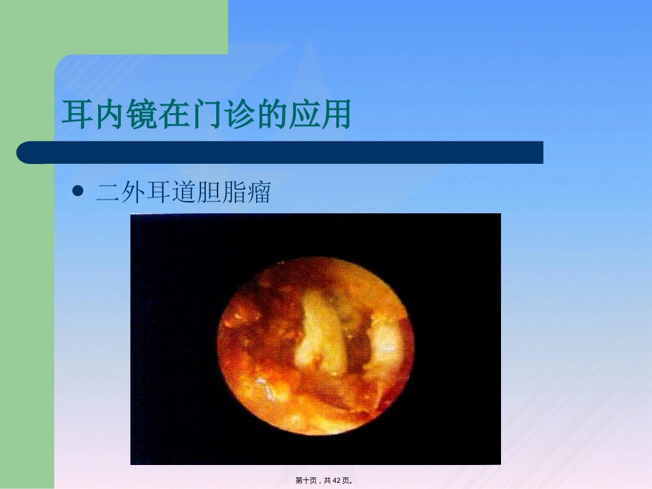耳内镜临床应用_第10页