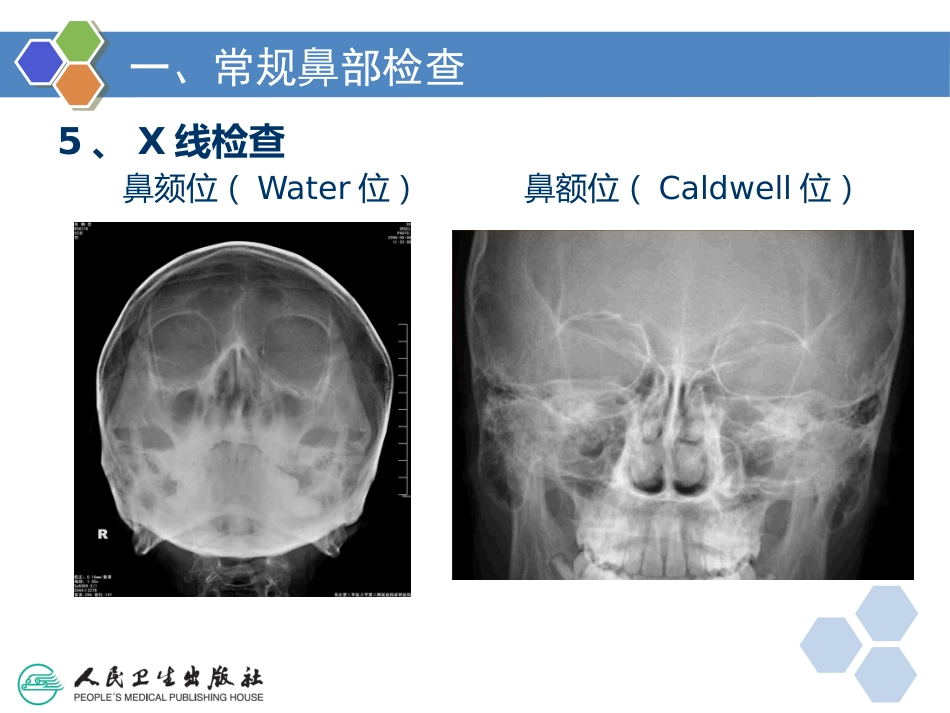 耳鼻咽喉检查法_第14页
