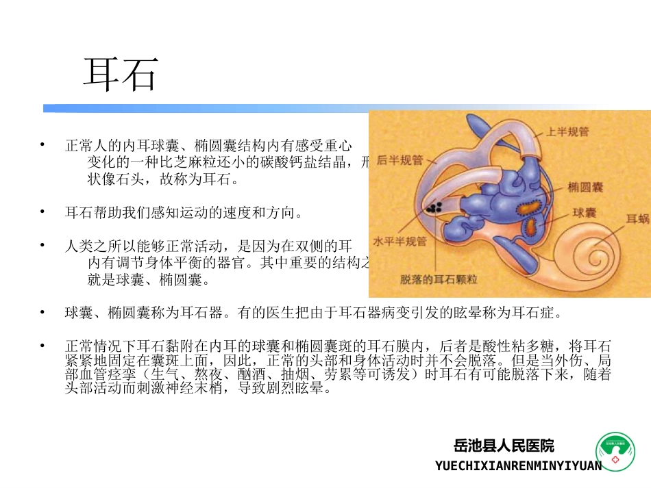 耳石症_第2页