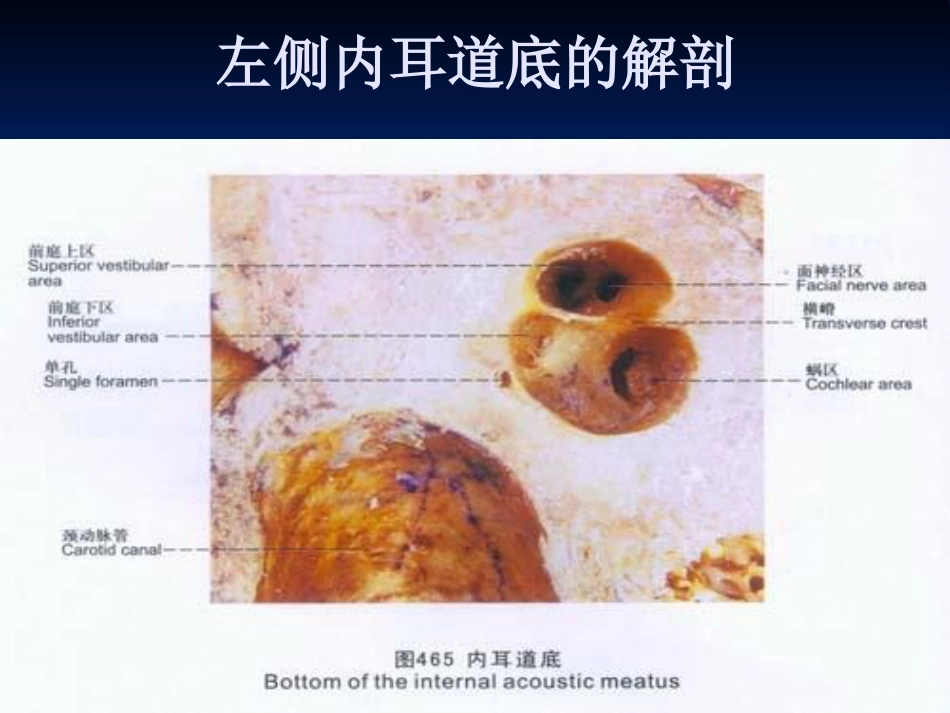 耳科解剖生理_第14页