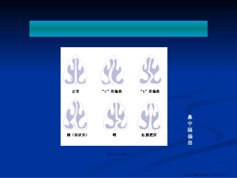 鼻中隔疾病学习教案_第7页