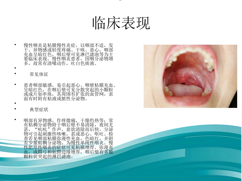 慢性咽炎_第5页