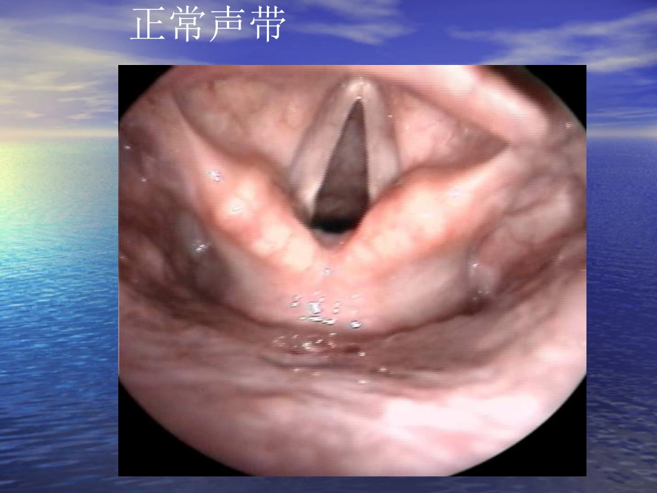 喉部疾病_第8页