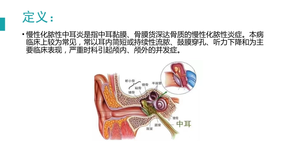 慢性化脓性中耳炎_第2页