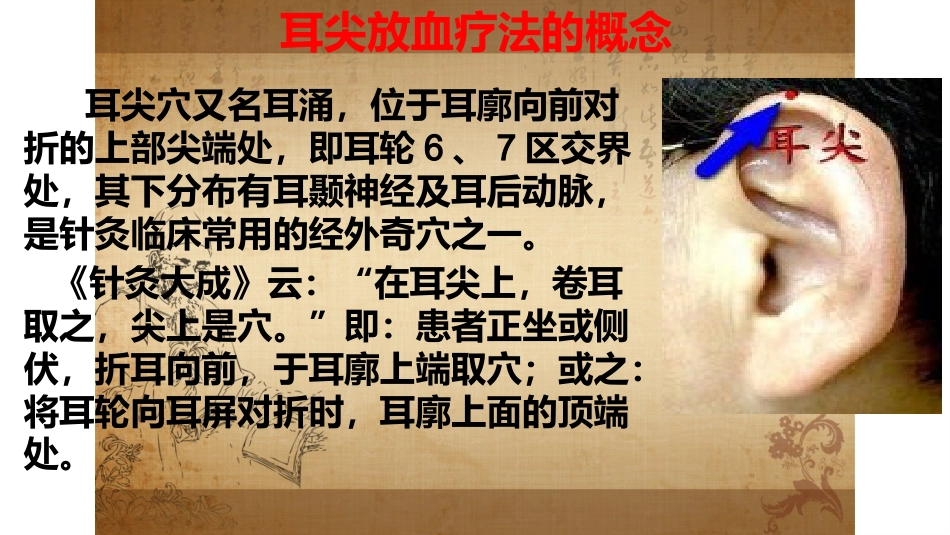 耳尖放血疗法_第3页
