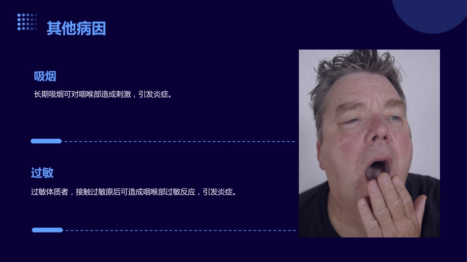 反流性咽喉炎医学_第11页