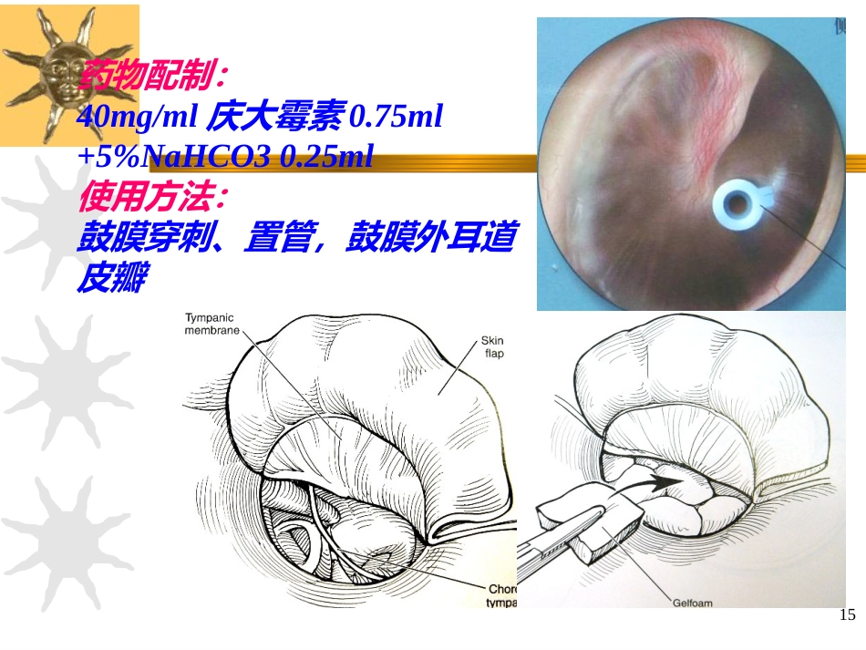 耳源性眩晕诊治ppt课件_第15页