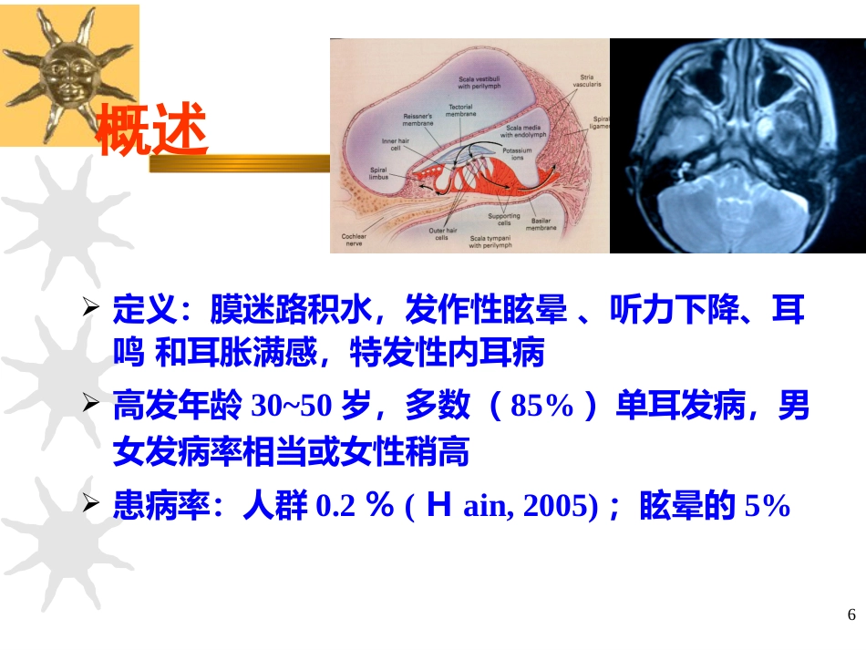 耳源性眩晕诊治ppt课件_第6页