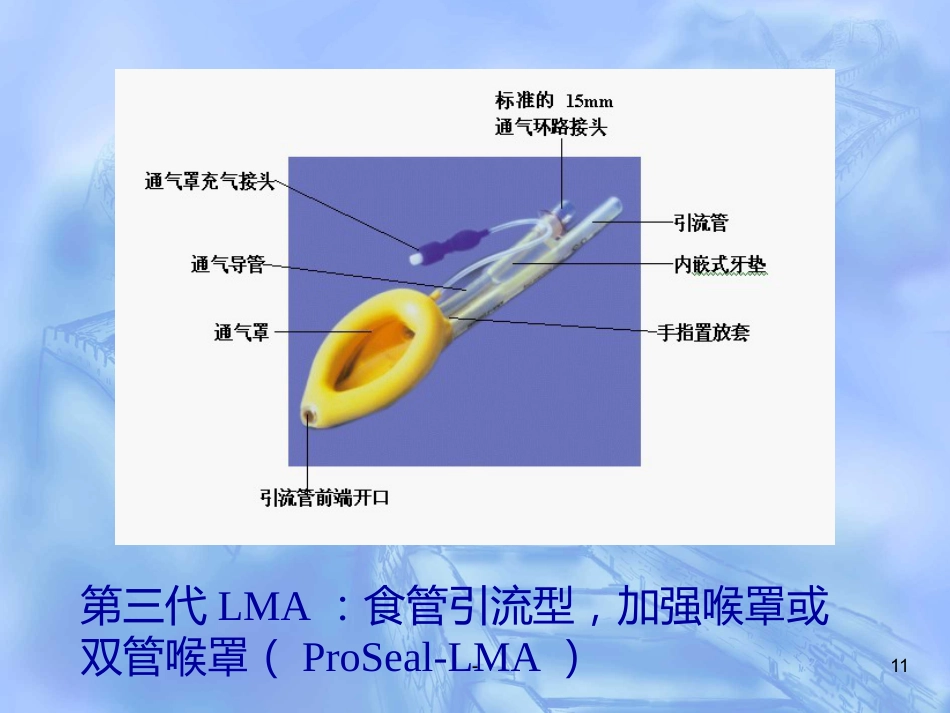 喉罩的进展及临床应用(上)_第11页