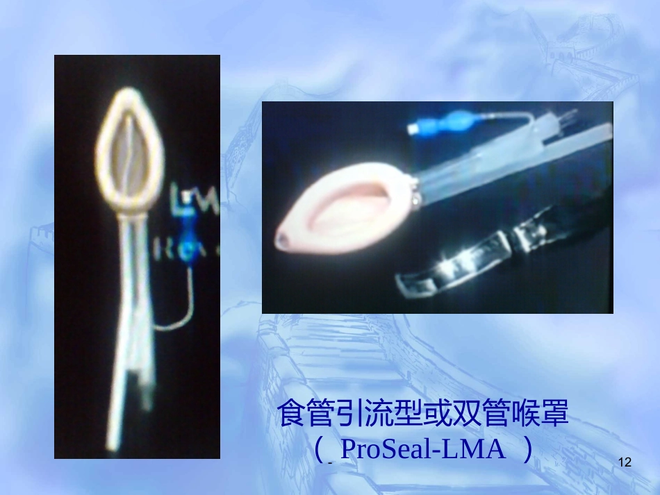 喉罩的进展及临床应用(上)_第12页