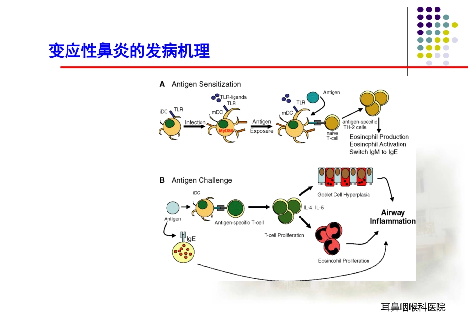 变应性鼻炎_第13页