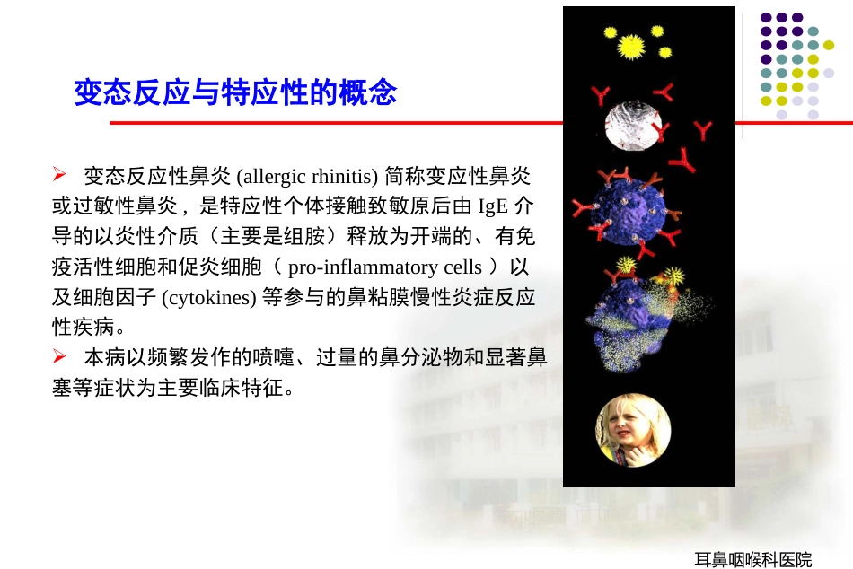变应性鼻炎_第4页