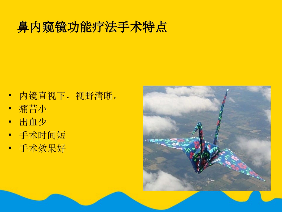 鼻中隔偏曲矫正术张影专选课件_第13页