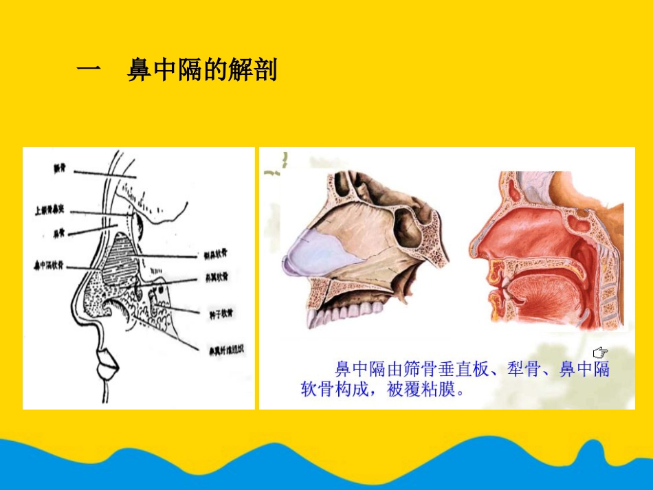 鼻中隔偏曲矫正术张影专选课件_第3页