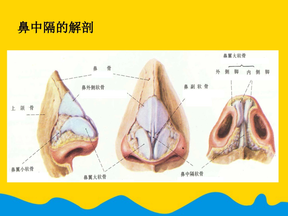 鼻中隔偏曲矫正术张影专选课件_第4页