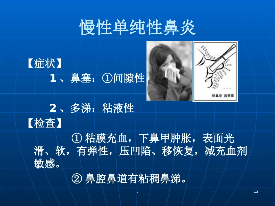 耳鼻喉学慢性鼻炎PPT参考课件_第12页