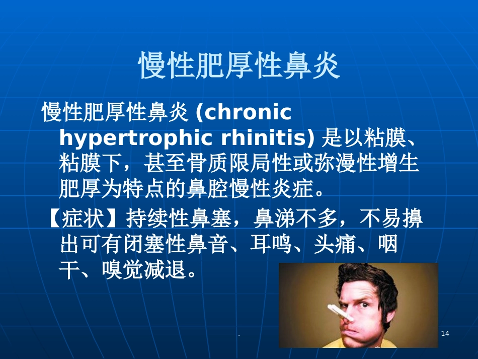 耳鼻喉学慢性鼻炎PPT参考课件_第14页