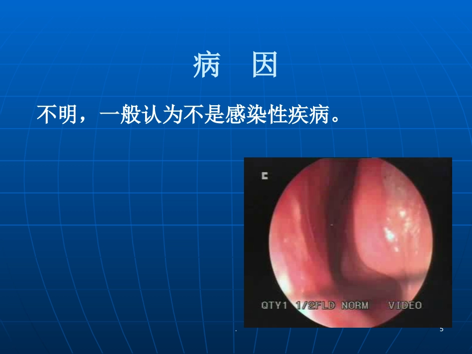 耳鼻喉学慢性鼻炎PPT参考课件_第5页