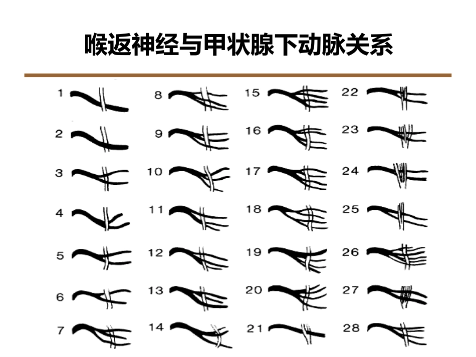 喉返神经解剖技术外科进展_第10页