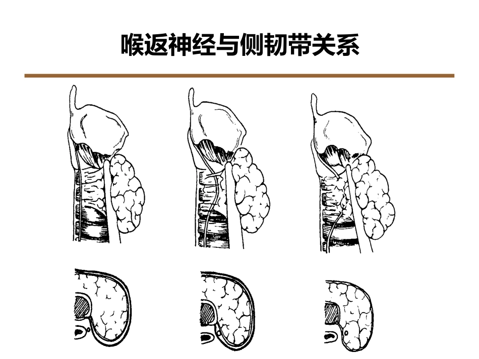 喉返神经解剖技术外科进展_第11页