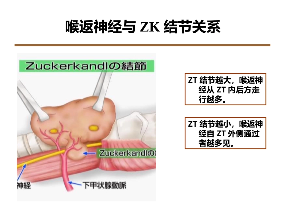 喉返神经解剖技术外科进展_第12页