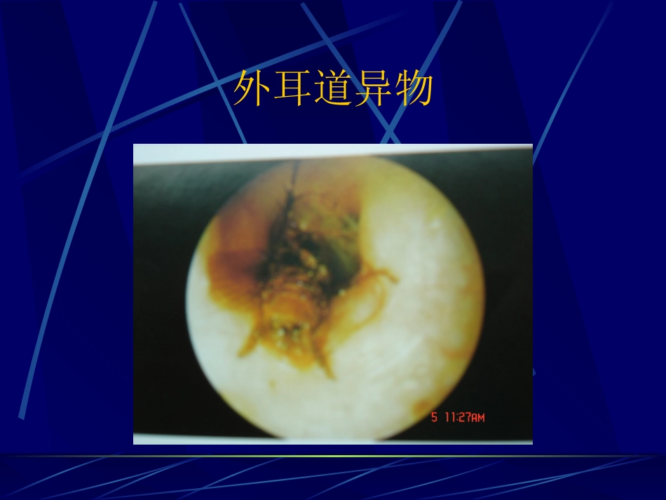 耳鼻咽喉解剖_第11页