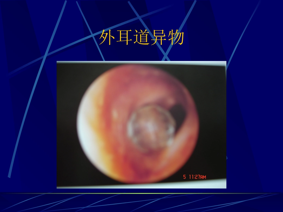 耳鼻咽喉解剖_第12页
