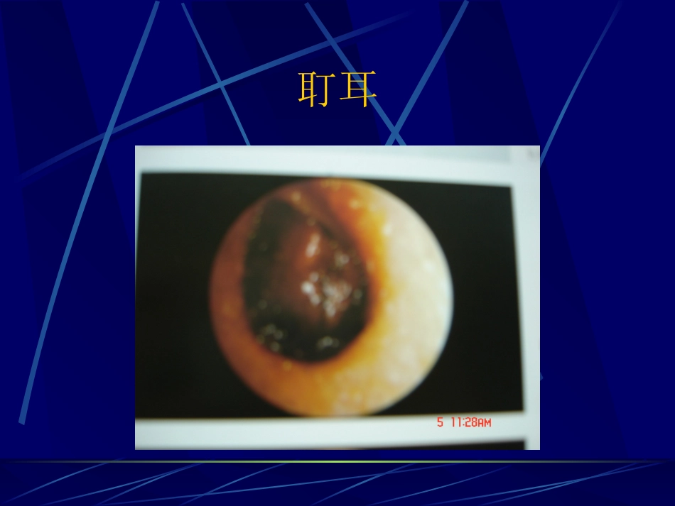 耳鼻咽喉解剖_第13页