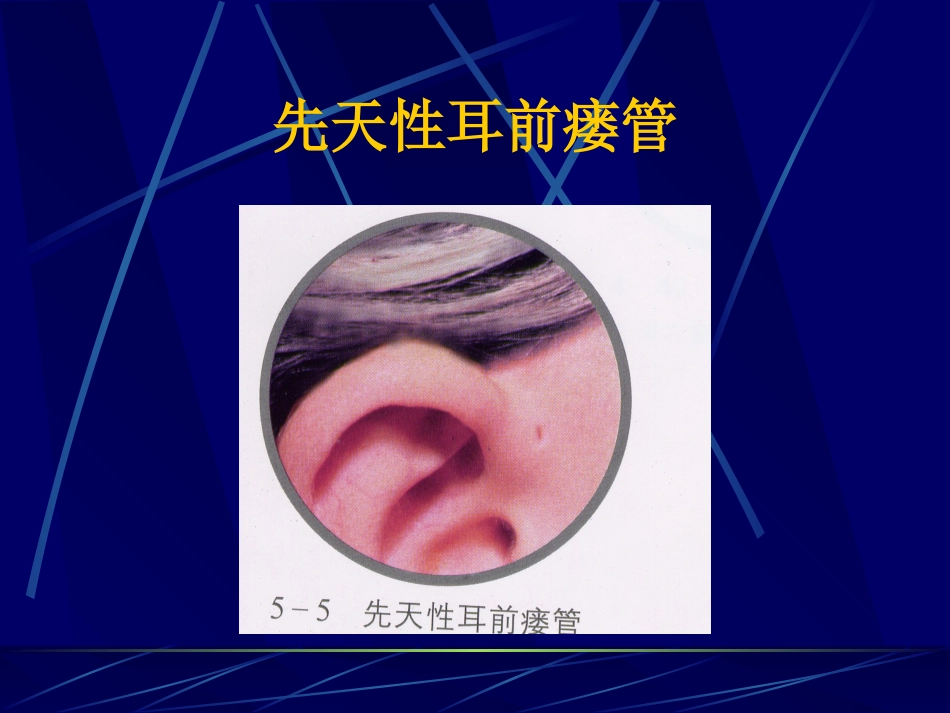 耳鼻咽喉解剖_第7页