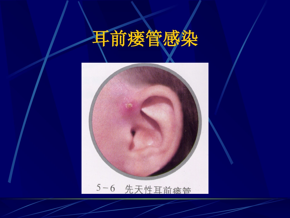 耳鼻咽喉解剖_第8页
