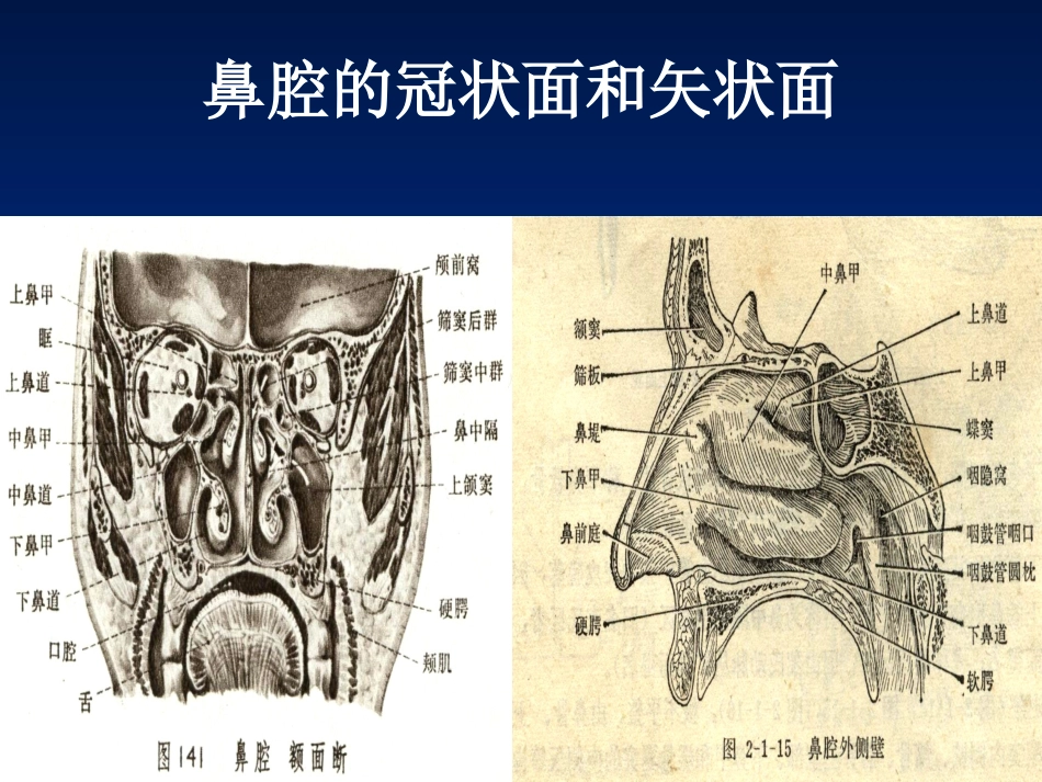 耳鼻咽喉科复习_第5页
