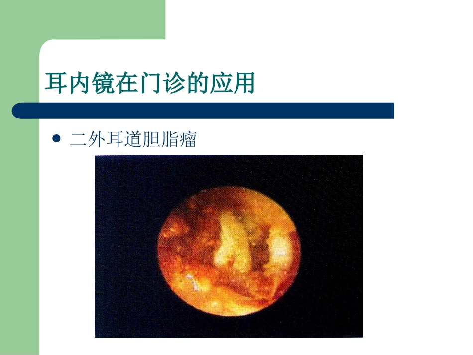 耳内镜的临床应用。谢和新_第11页