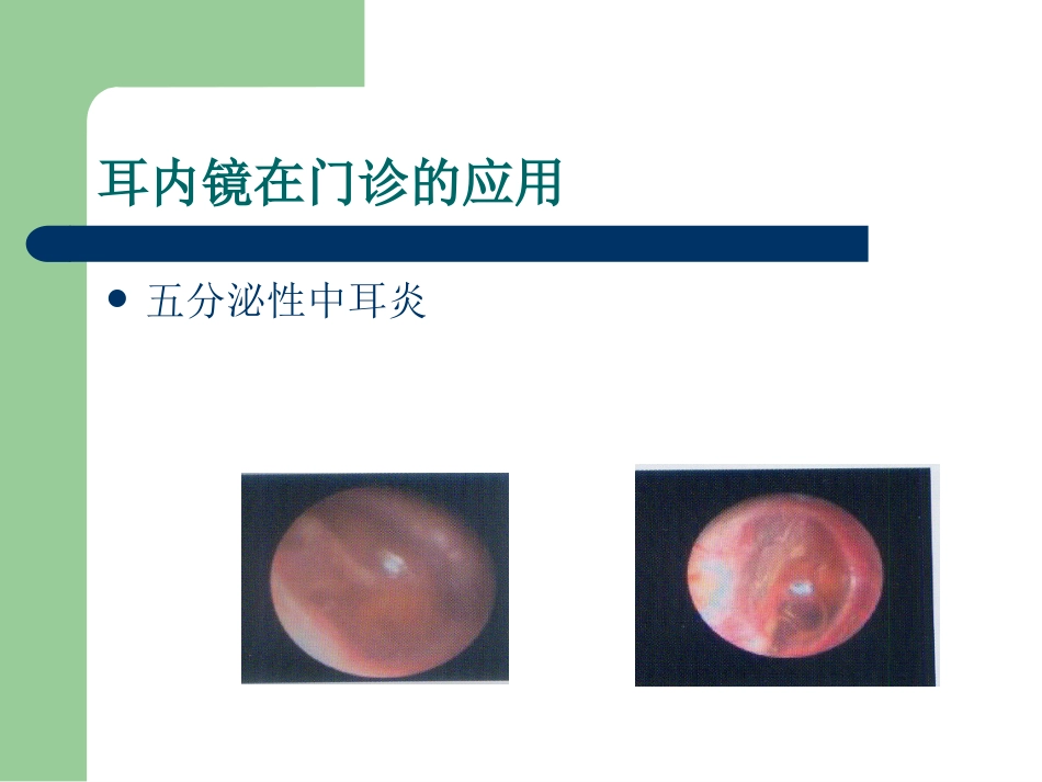耳内镜的临床应用。谢和新_第15页