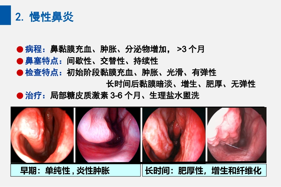耳鼻喉头颈外科PPT课件 鼻炎_第12页