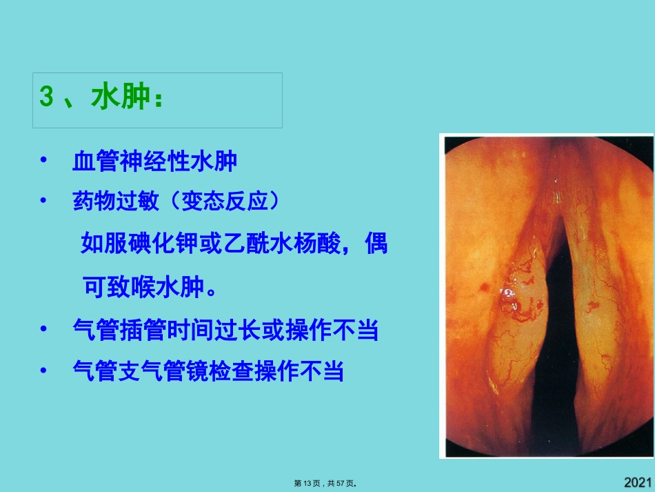 耳鼻咽喉头颈外科学喉阻塞_第13页