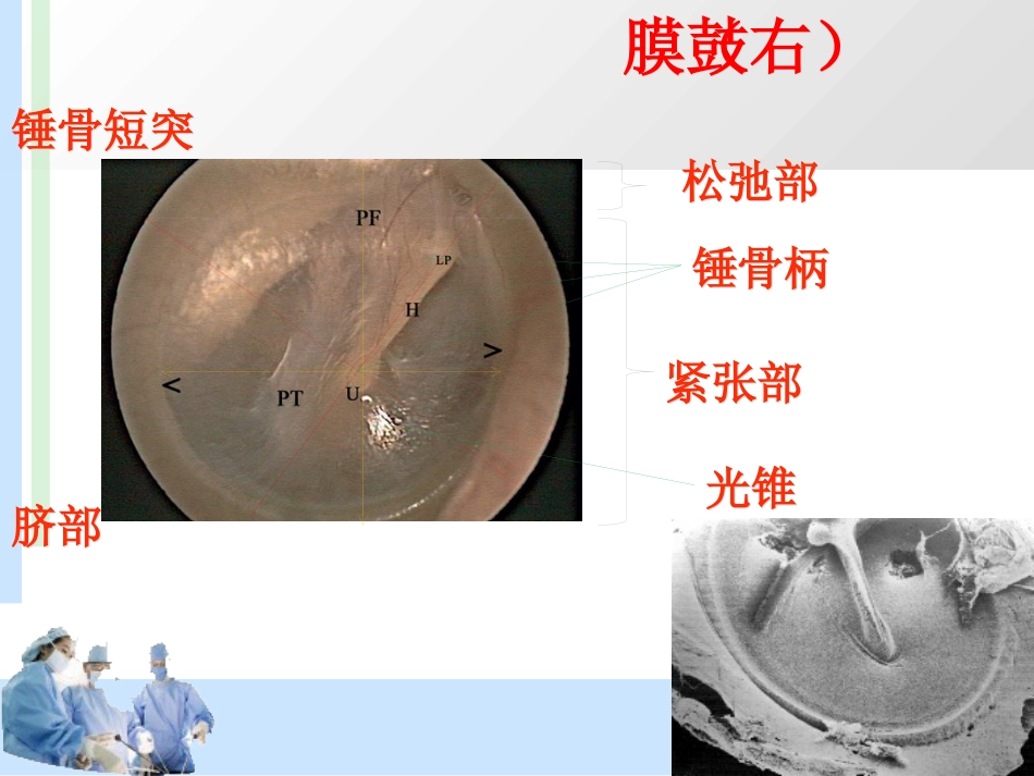 耳解剖及分泌性中耳炎 耳鼻喉科学_第14页