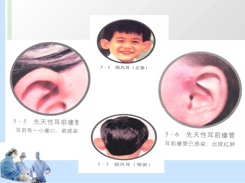 耳解剖及分泌性中耳炎 耳鼻喉科学_第7页