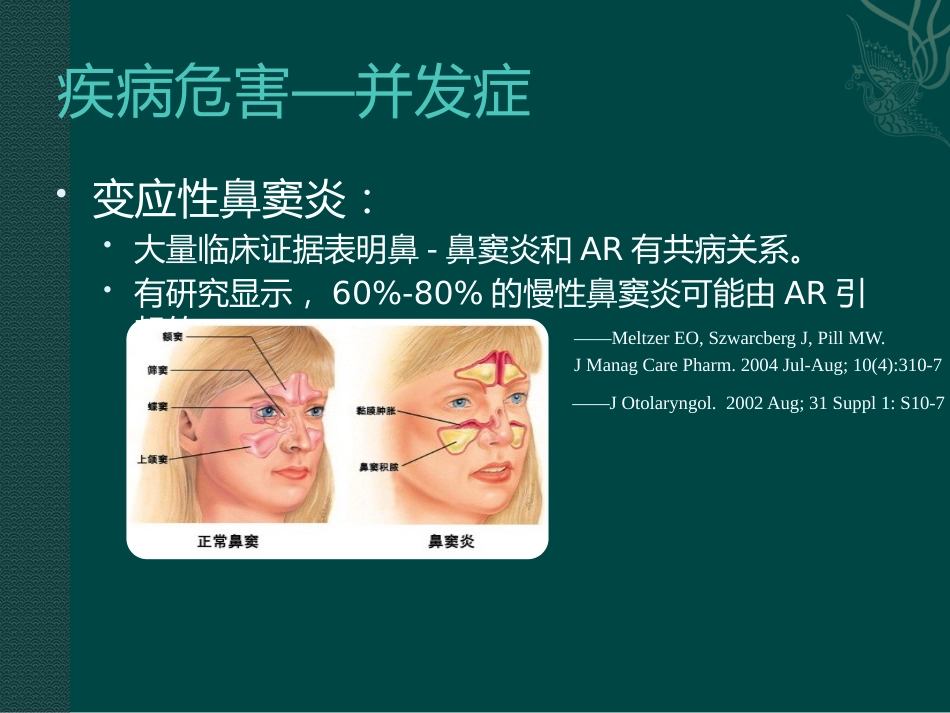 儿童变应性鼻炎_第11页