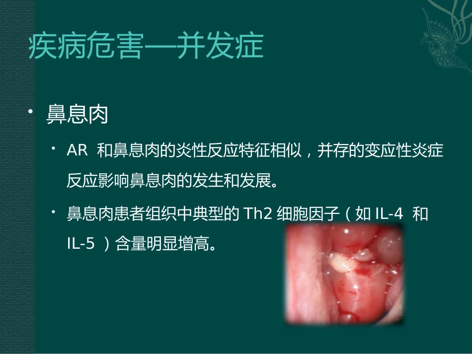 儿童变应性鼻炎_第13页