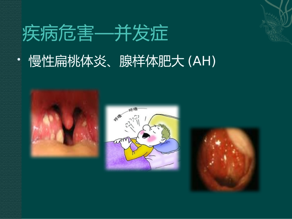 儿童变应性鼻炎_第14页