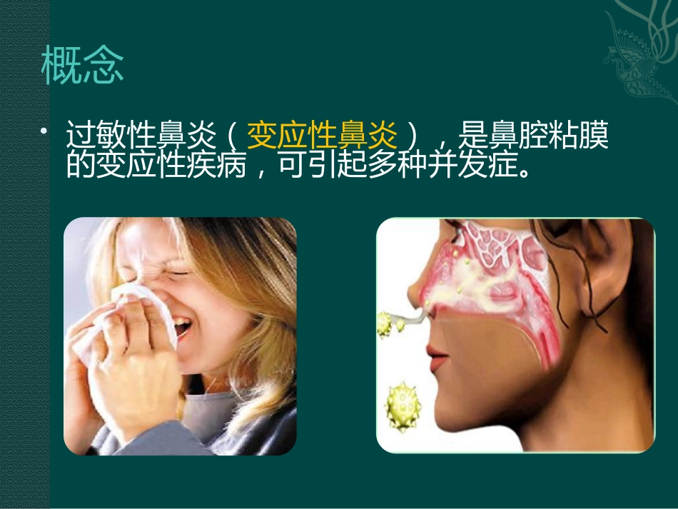 儿童变应性鼻炎_第3页