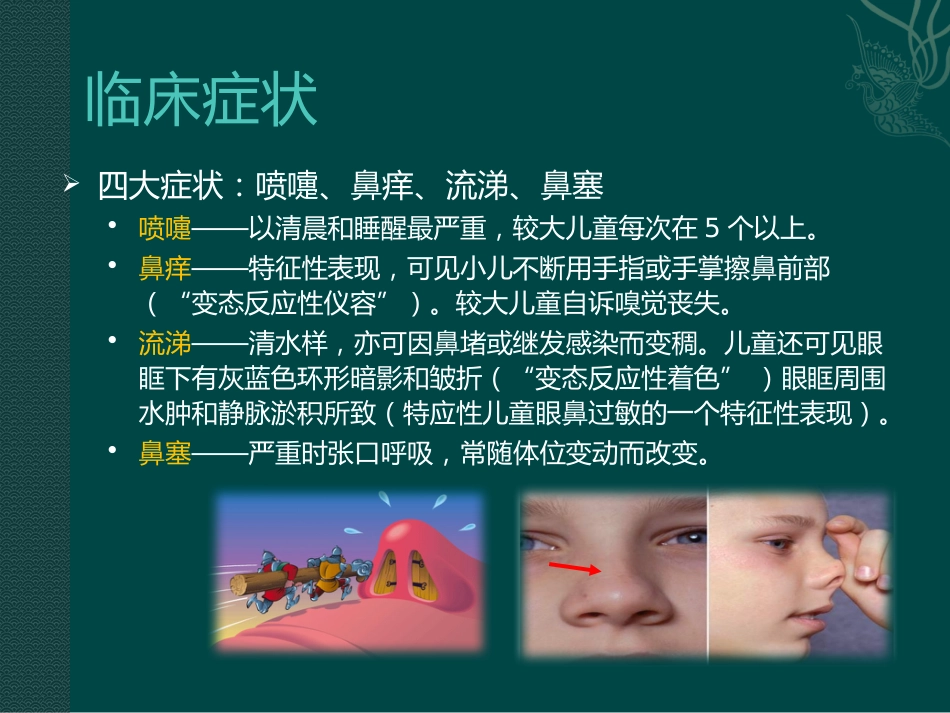 儿童变应性鼻炎_第9页
