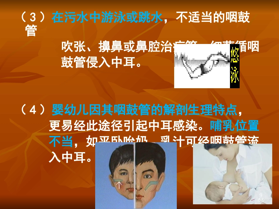 急性化脓性中耳炎ppt课件_第9页