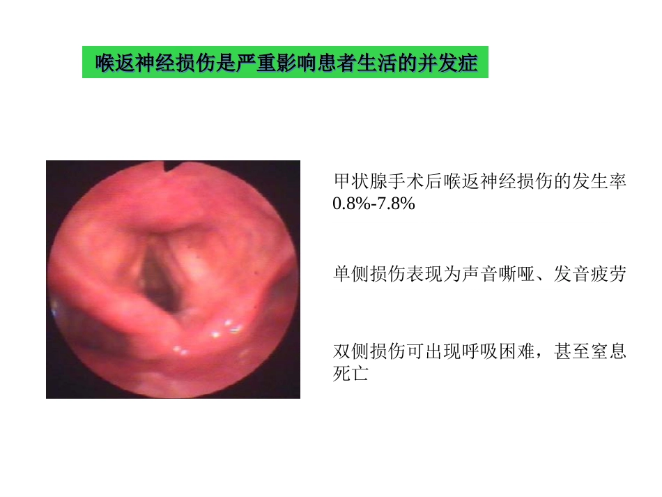 甲状腺术中喉返神经损伤原因与教训_第2页