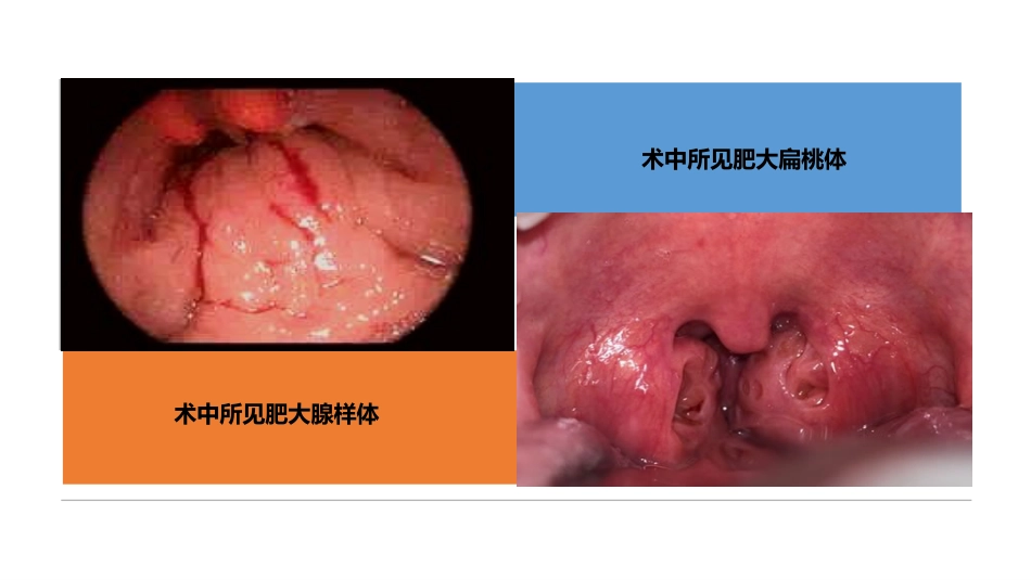 耳鼻喉科病例分享_第13页