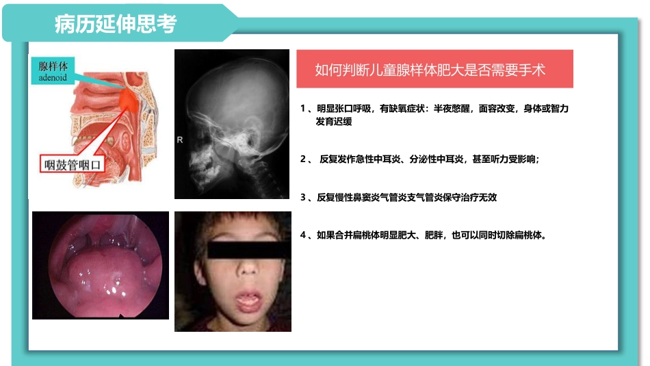 耳鼻喉科病例分享_第15页