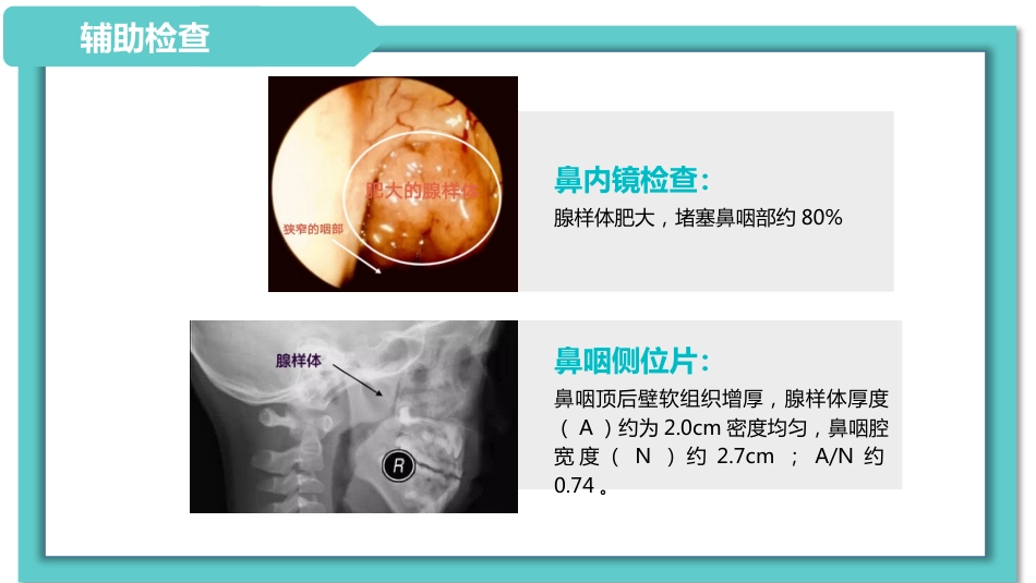 耳鼻喉科病例分享_第8页
