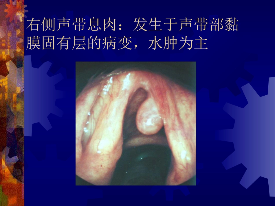喉阻塞_第10页
